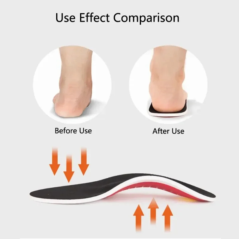 Ортопедические стельки EVA для – обзор и цена Men'S Shoes For Plantar Fasciitis